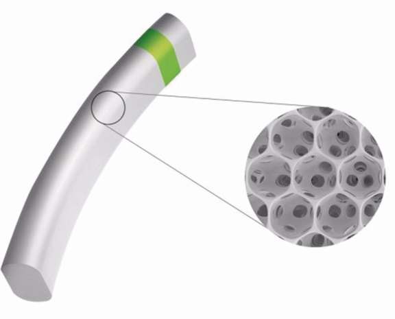 Figure 2. MINIject® (source : iStar Medical).