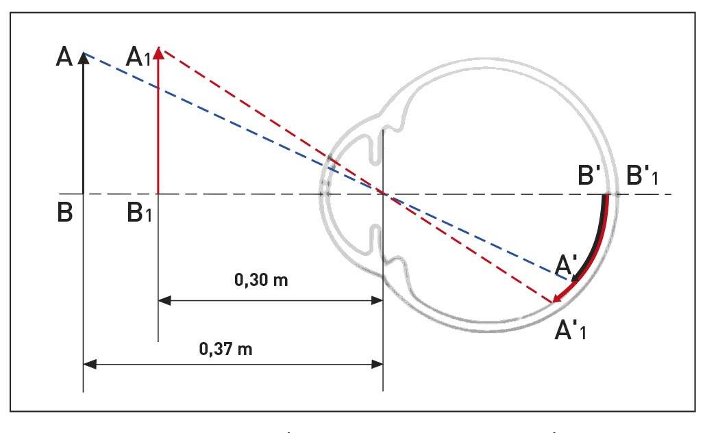 Figure 1. Grossissement lié au rapprochement. Le même objet AB vu à 0,30 m par rapport à 0,37 m subit une magnification égale au rapport de ces 2 distances : 0,37/0,30 = 1,23X, soit 23%.
