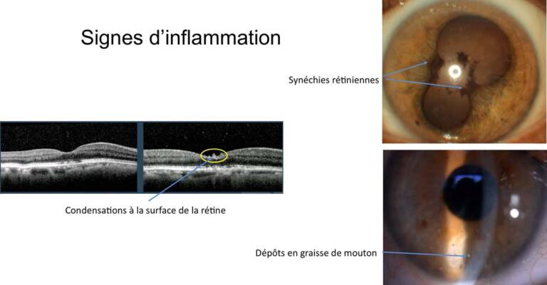Figure 3. Signes d’inflammation.
