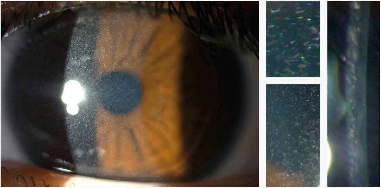 Figure 1. Photographies en lampe à fente.
