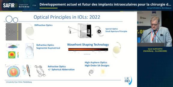 Figure. Développement actuel et futur des implants intraoculaires pour la chirurgie de la cataracte
