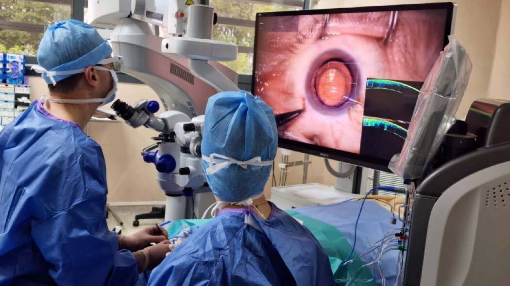 Figure 5. Utilisation de la 3D lors d’une chirurgie combinée cataracte-greffe lamellaire postérieure.
