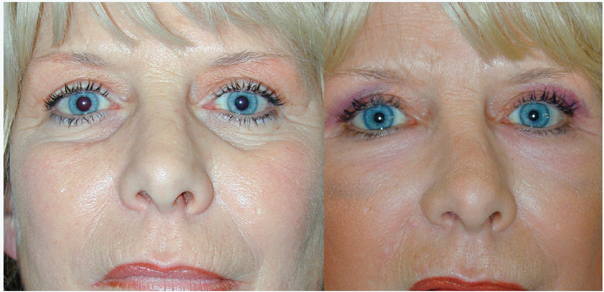 Figure 15. Résultat Avant-Après.
