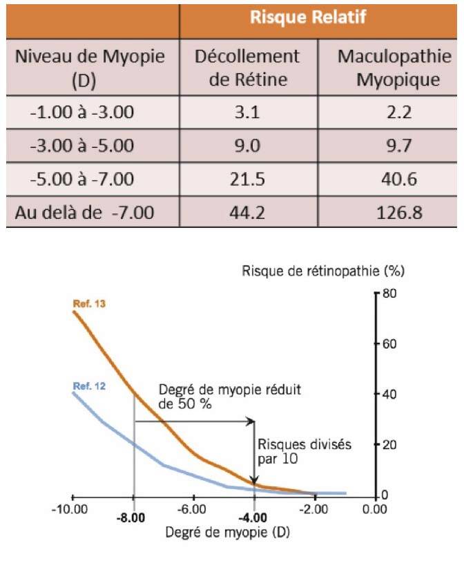 Figure 4. Risque rétinien en fonction du niveau de myopie, intérêt de la freination.

