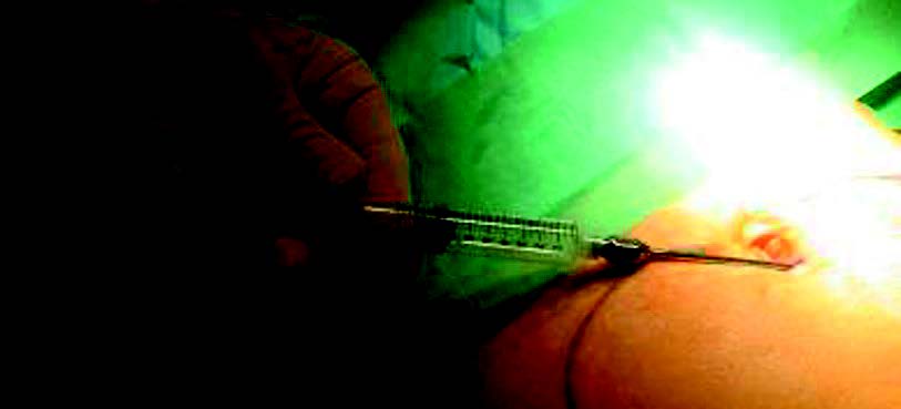 Figure 8. Prélèvement ventre.
