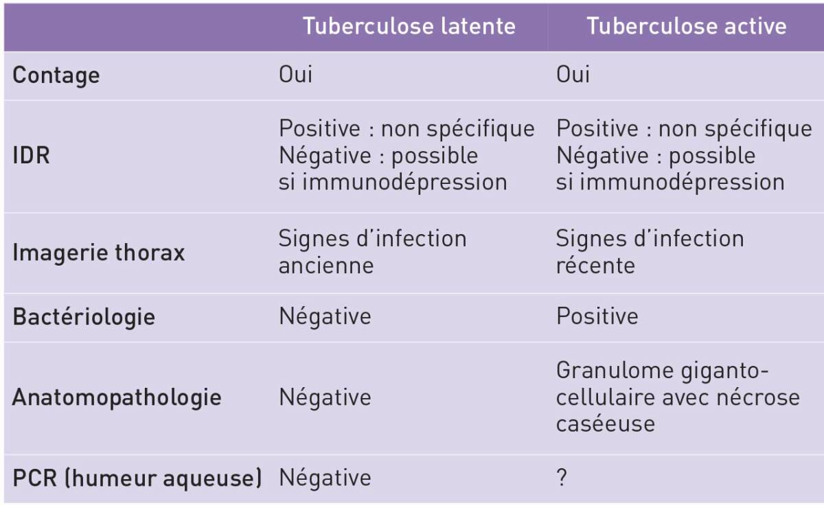 Tableau II. Éléments de diagnostic positif entre la forme latente et la forme active de la tuberculose.

