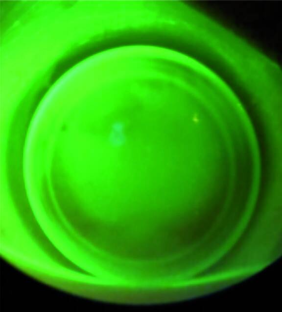 Figure 1. Image fluo homogène d’une lentille sphérique sur cornée sphérique.
