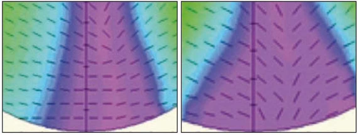 Figure 3. A gauche : astigmatisme résiduel VP en verre Soft-Design. A droite : astigmatisme résiduel VP en verre Hard-Design.
