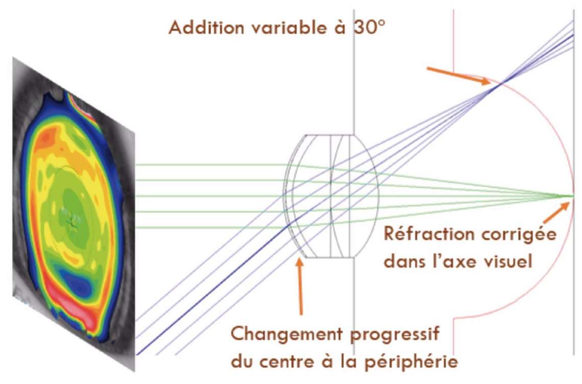 Principe du gradient de puissance (gamme Amyopic) mis en évidence grâce à une topographie sur lentille.&nbsp;
