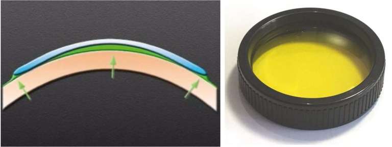 Figure 11. à gauche : lentilles serrées, au centre : lentilles alignées, à droite : lentilles plates.
