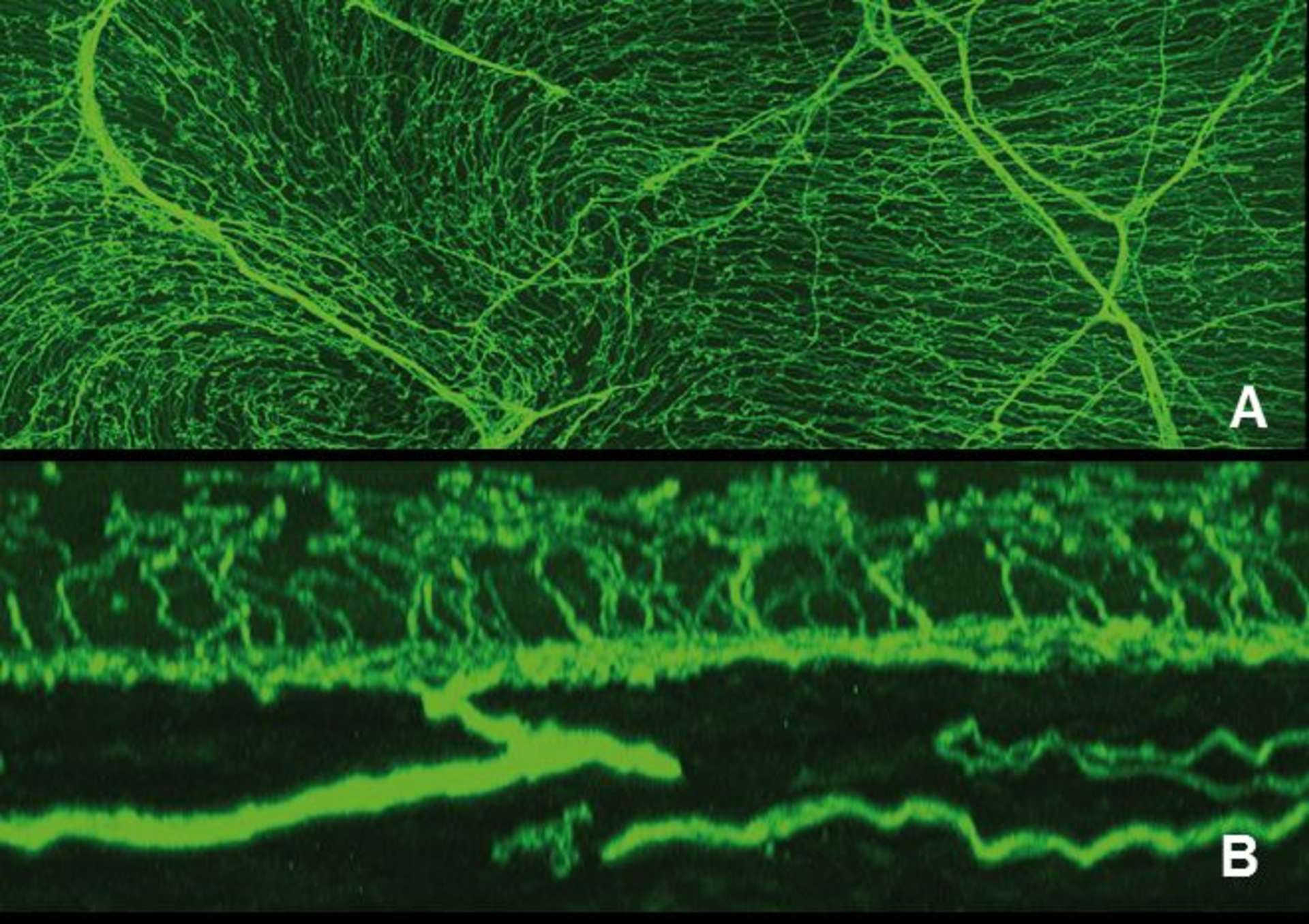 Figure 1. Innervation cornéenne vue en microscopie confocale (souris transgénique exprimant une protéine fluorescente dans les axones cornéens).
A. Vue de face. B. Vue en coupe.
