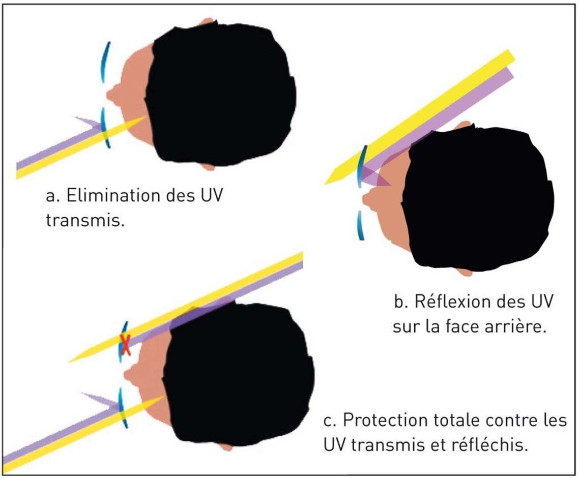 Principe de la double protection contre l’UV dans un verre ophtalmique
