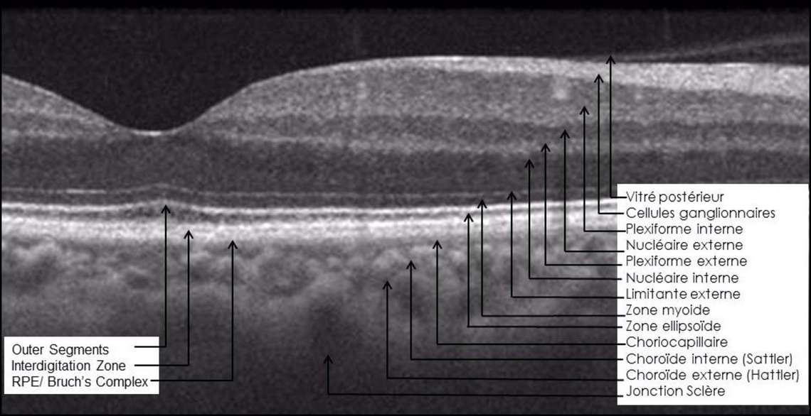 Coupe fovéale normale en tomographie en cohérence optique spectral domaine et en mode B-scan
