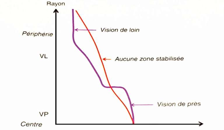 Figure 1. Une lentille à profil stabilisé aura une plage de VL et de VP sphériques et une zone de vision intermédiaire asphérique (courbe bleue). Une lentille entièrement asphérique aura une transition plus douce au prix d’une image moins « piquée » (source : Catherine Peyre, Rapport SFO, Les lentilles de contact).
