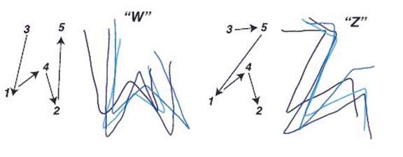 Cette image montre des formes de lettres (W et Z) créés par différents modèles de stimulation dynamique, avec le modèle de stimulation à gauche et le dessin du participant à droite.
